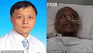 Coronavirus la peau de deux médecins chinois infectés devient noire 2