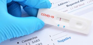 Covid-19 : des tests sont désormais disponibles en pharmacie