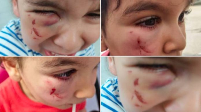 Paris une toxicomane agresse un enfant de 2 ans dans sa poussette